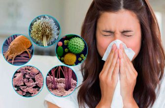 Аллергия на пылевого клеща: симптомы, лечение